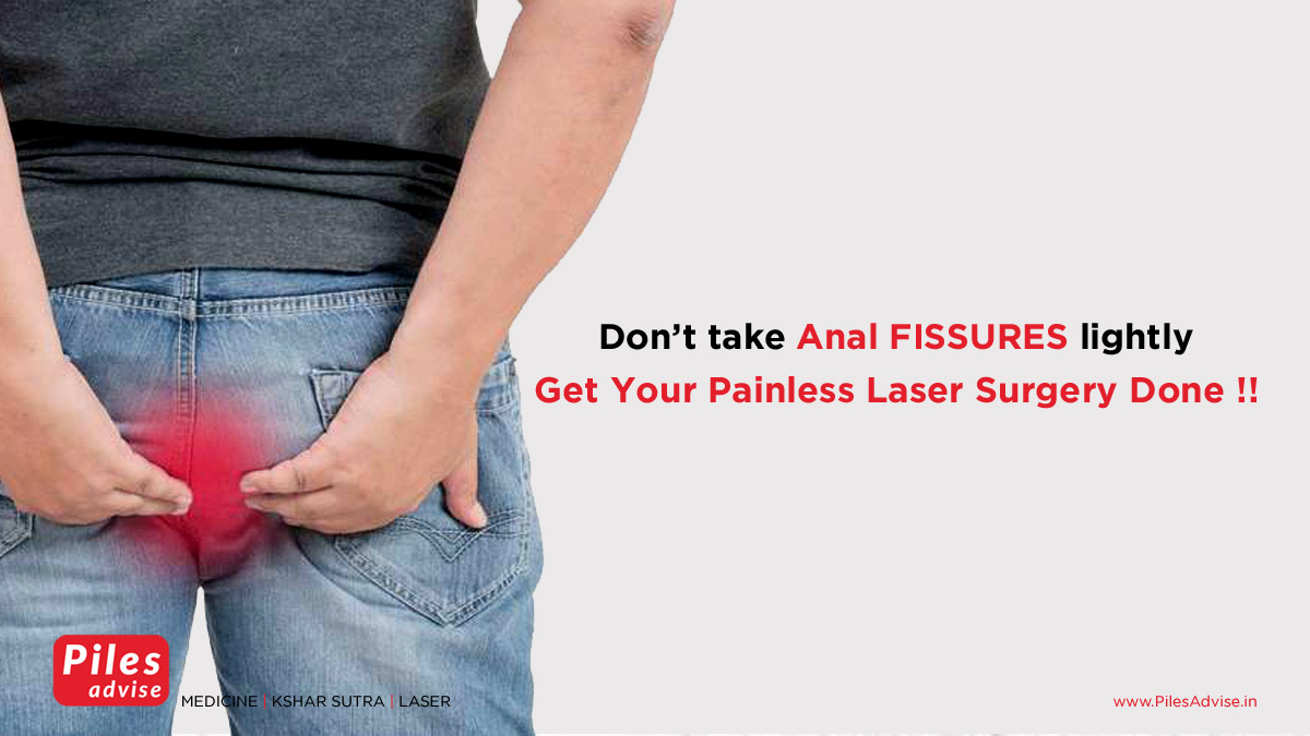 Laser Treatment for Anal Fissure at Piles Advise Dehradun